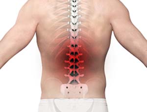 Back and Neck Pain