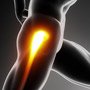 Perthes Disease